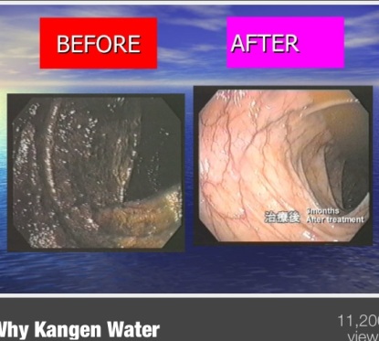 why-kangen-water